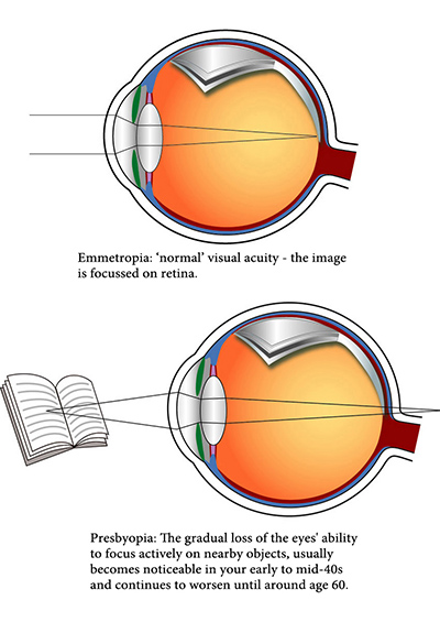 Пресбиопия что это. Retina Focus. Normal Visual Acuity. Active Focus Eye. Emmetropia Equinox.